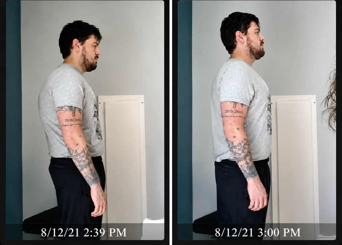 Side-view posture of a Better Life Chiropractic patient before and after a single Advanced Biostructural Correction visit: the head and shoulders move back over the body